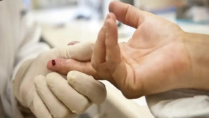 Sesab desmente surto de HIV entre adolescentes na Bahia